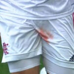 Gustavo Henrique, con el pantalón ensangrentado después de sufrir un corte en un testículo.