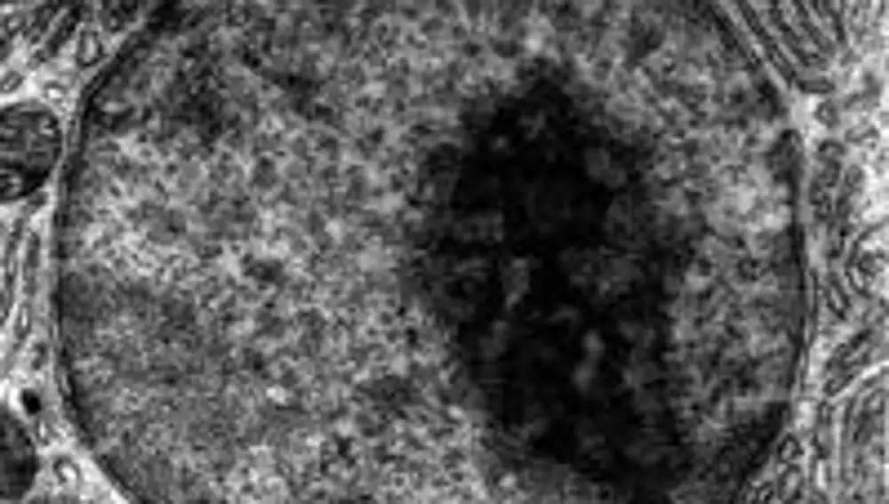 Una imagen de microscopio electrónico del núcleo de una célula, en la que podemos apreciar la membrana que lo separa del resto de la célula. También vemos en el interior del núcleo una mancha oscura, el nucleolo. En el exterior del núcleo vemos un gran número de membranas, que forman parte del retículo endoplasmático.