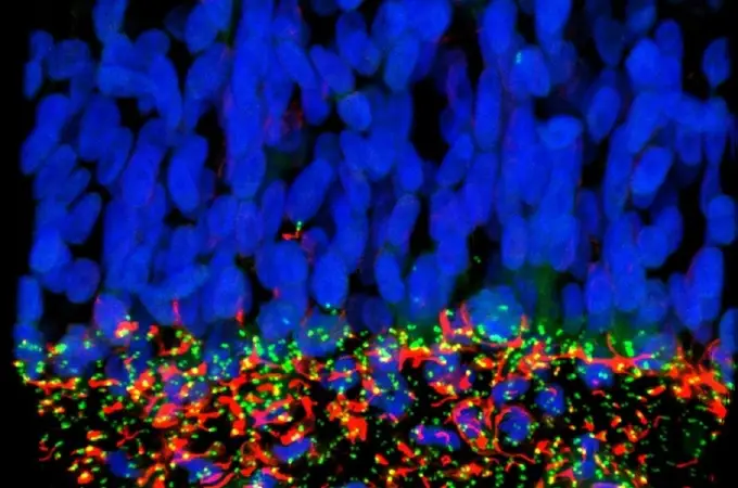 Crean células madre sin memoria 