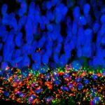 Células madre neurales en un embrión (en azul). Los cilios primarios, marcados en rojo, y las proteínas de la base del cilio (en verde) se ven afectados por la proteína NS5 del virus Zika, lo que desencadena la parada del crecimiento del cerebro del feto