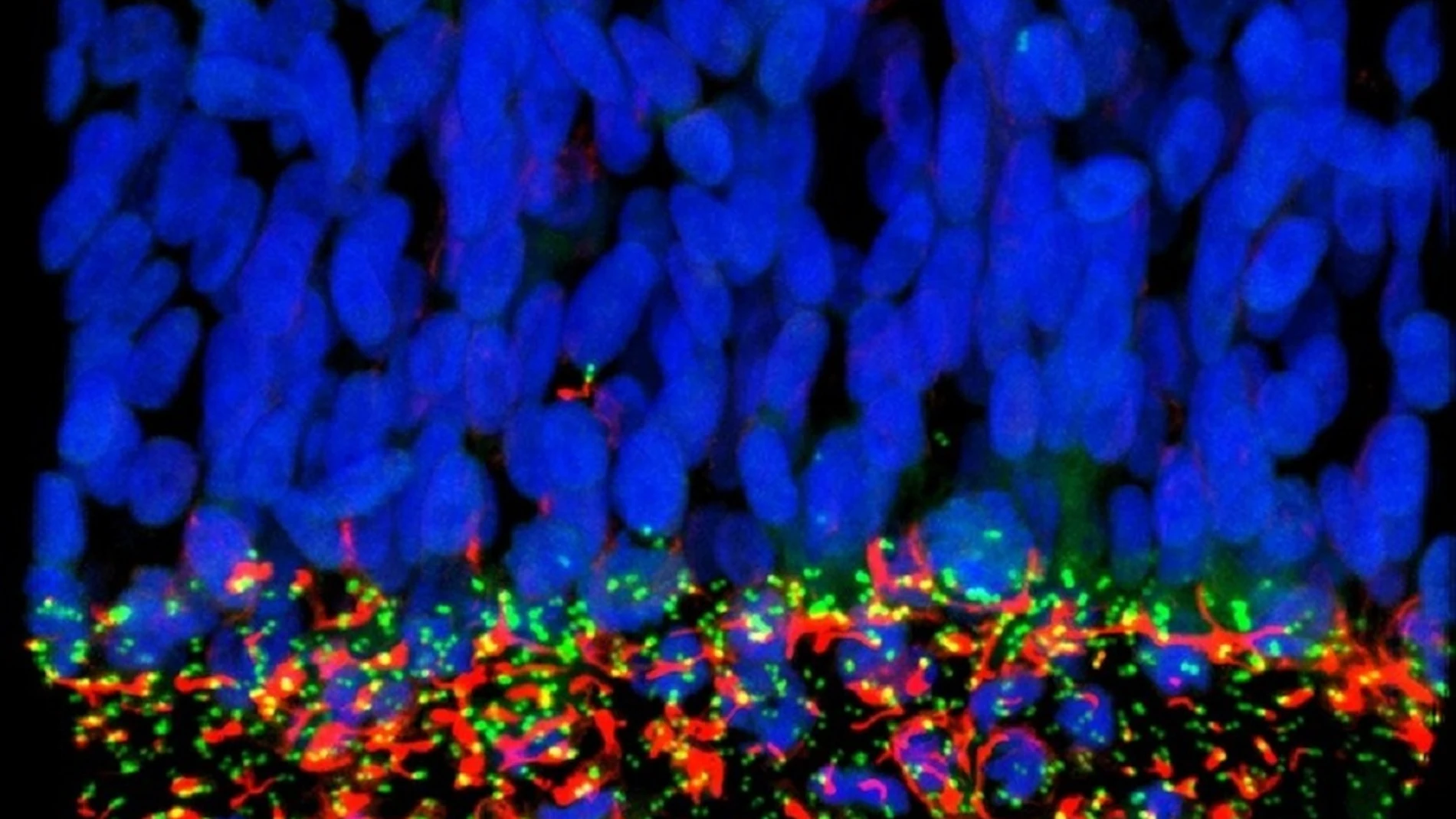 Células madre neurales en un embrión (en azul). Los cilios primarios, marcados en rojo, y las proteínas de la base del cilio (en verde) se ven afectados por la proteína NS5 del virus Zika, lo que desencadena la parada del crecimiento del cerebro del feto