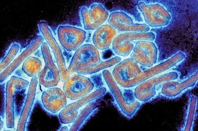 Lo que sabemos de Chapare, el nuevo virus mortal que alarma a los científicos