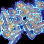 Chapare, el nuevo virus mortal similar al Ébola.