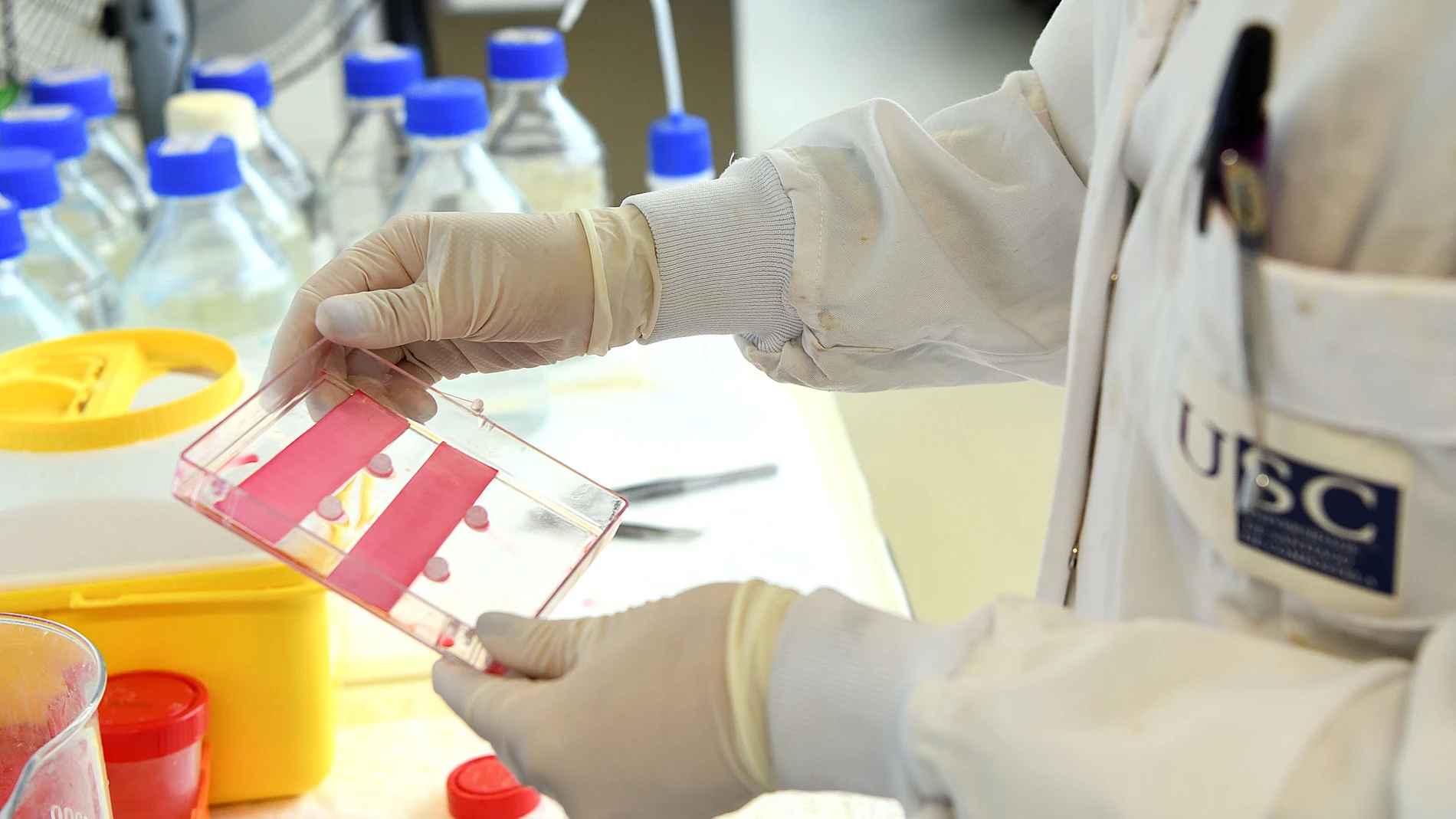 Cuatro investigaciones de la USC exploran mecanismos de detección, antivirales y un proyecto de vacuna