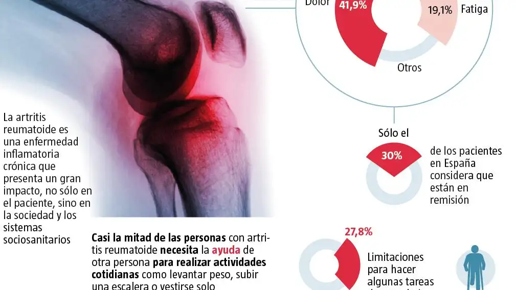 Artritis reumatoide