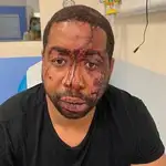  La brutal paliza a un negro desata la cólera por la violencia policial