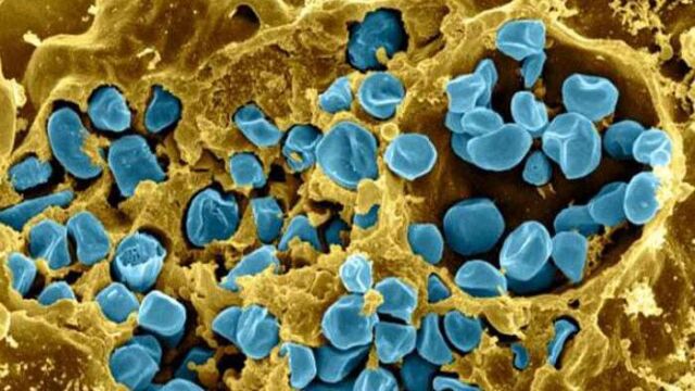 La bacteria ‘Francisella tularensis’, causante de la tularemia.