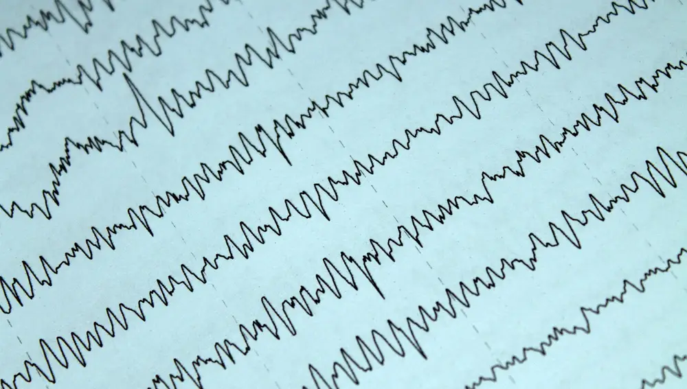 Es posible ver las ondas de actividad del cerebro mediante un electroencefalograma | Fuente: Pixabay