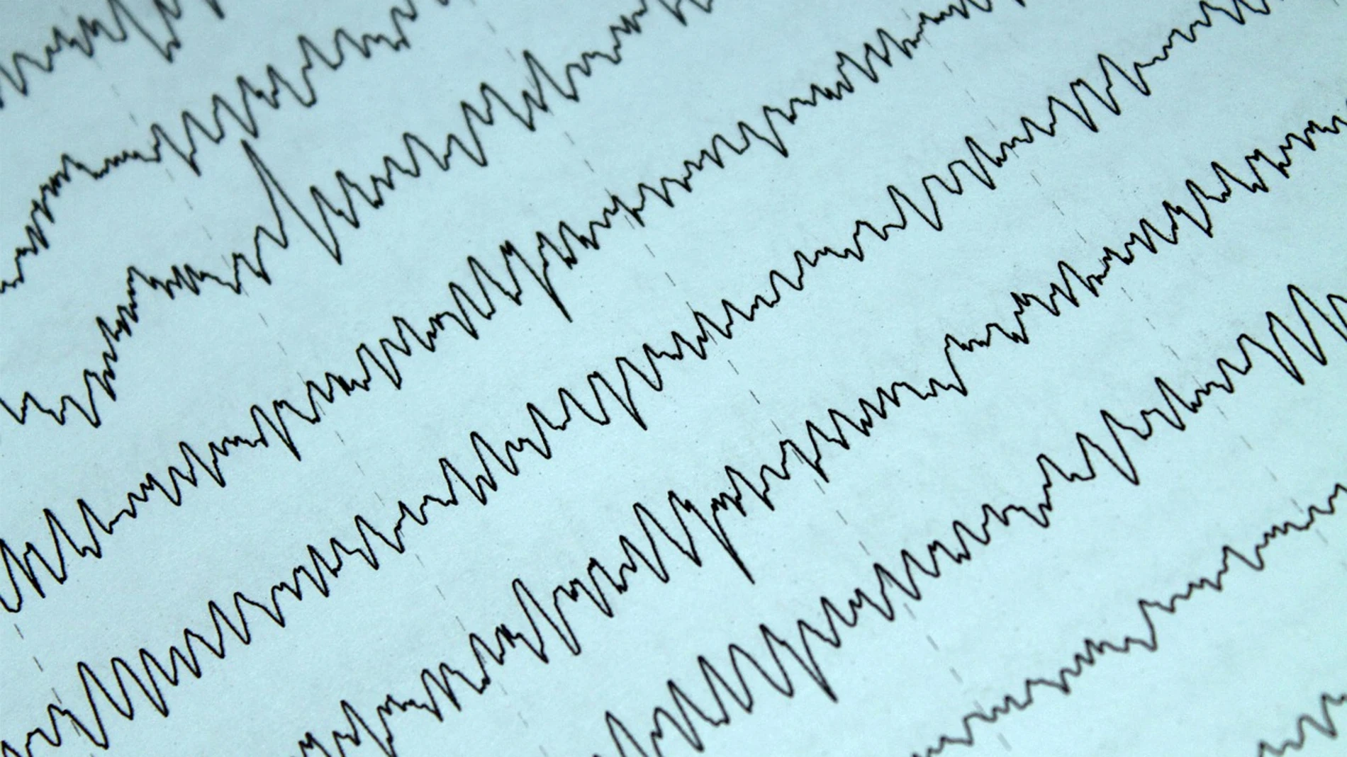 En un electroencefalograma, es posible ver las ondas de actividad en diferentes partes del cerebro, detectando el ritmo epiléptico.