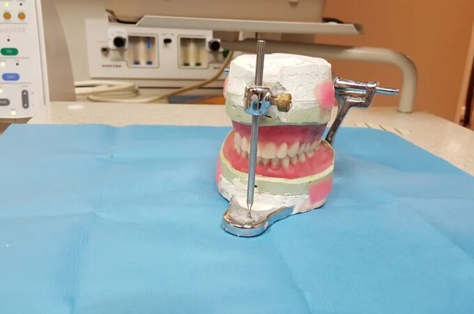 Los implantes dentales se han consolidado como una de las mejores soluciones que se pueden encontrar actualmente en el ámbito odontológico.