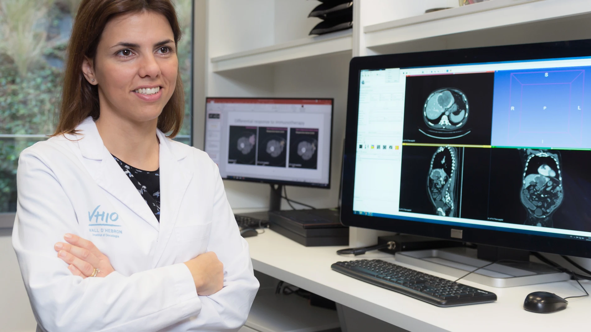 La doctora Pérez-López ha liderado el trabajo para desarrollar y validar el nuevo modelo radiómico