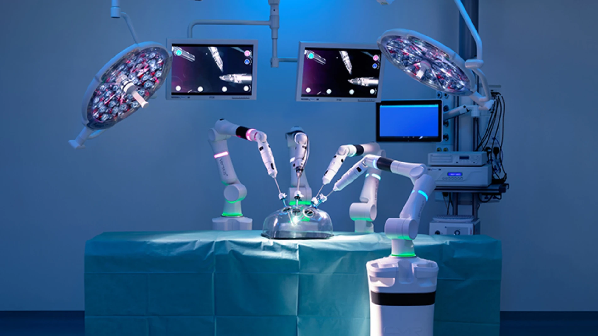 Los brazos del Versius sirven para administrar radioterapia desde diversos ángulos