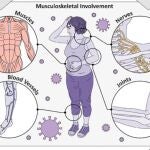 Imagen del estudio desarrollado por la Universidad de Northwestern (EE UU) sobre los nuevos síntomas del coronavirus