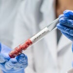 El 30% del consumo total de carne en el año 2040 será procedente de la investigación, según las previsiones de algunos estudios internacionales