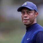 Tiger Woods se recupera del grave accidente que sufrió a finales de febrero.