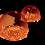 Protocélulas formadas espontáneamente en una tinción fluorescente. Puede verse en su interior una serie de compartimentos muy reveladores para entender la historia de la vida en la Tierra.