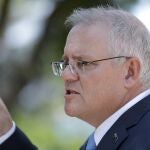 Australia's Prime Minister Scott Morrison speaks to the media in Sydney, Monday, March 1, 2021. Morrison stood by an unnamed Cabinet minister against calls for him to step down from office over an allegation that he raped a 16-year-old girl more than 30 years ago. (AP Photo/Rick Rycroft)