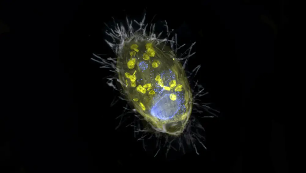Imagen de una bacteria tomada mediante un microscopio electrónico en la que se han resaltado en amarillo los endosimbiontes Candidatus Azoamicus ciliaticola.