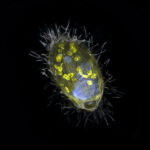 Imagen de una bacteria tomada mediante un microscopio electrónico en la que se han resaltado en amarillo los endosimbiontes Candidatus Azoamicus ciliaticola.