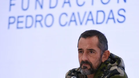 El doctor y cirujano plástico, Pedro Cavadas
