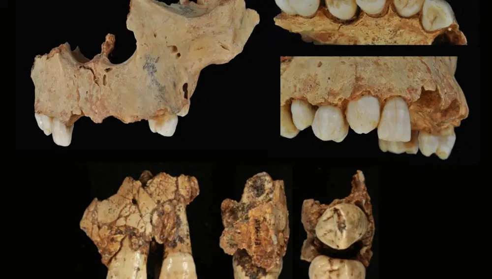 Imagen de los dientes hallados en una cueva en el sur de China, unos de los pocos fósiles humanos que se conocen en China del Pleistoceno inferior tardío; que aportan información sobre el poblamiento temprano de Asia continental | Fuente: CENIH