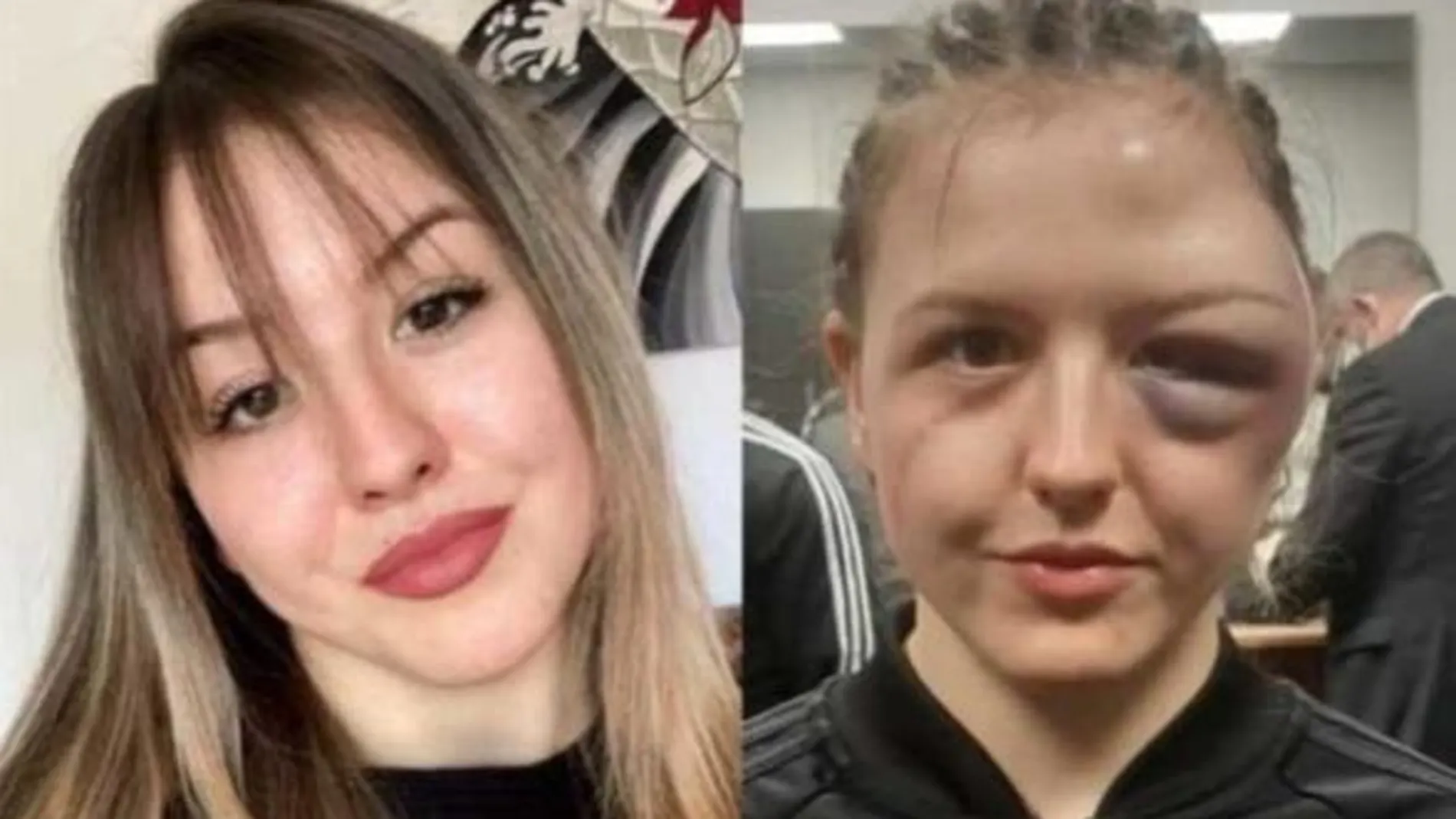 El antes y el después de Cheyenne Hanson