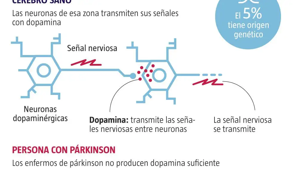 Párkinson