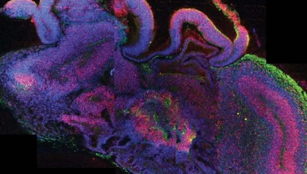 Imagen de 2018 de un organoide de cerebro teñido para ver las capas que lo conforman.