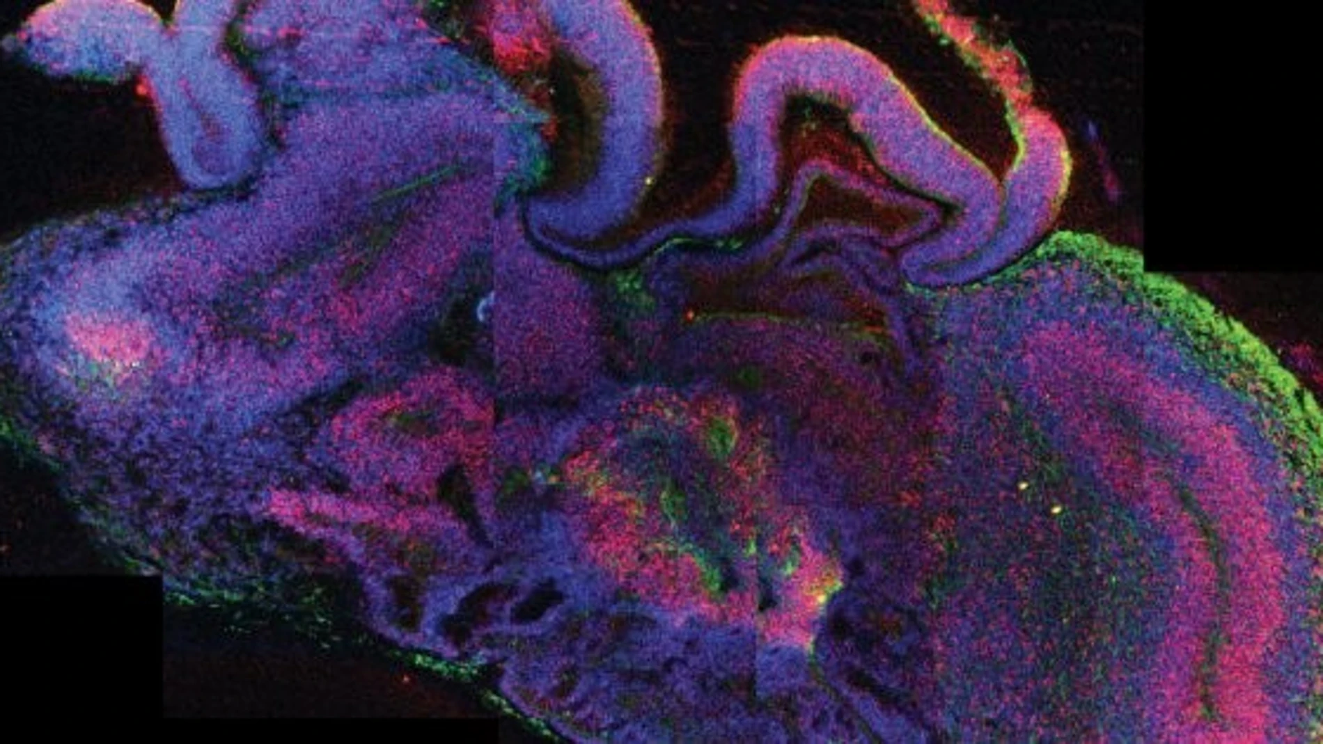 Imagen de 2018 de un organoide de cerebro teñido para ver las capas que lo conforman.