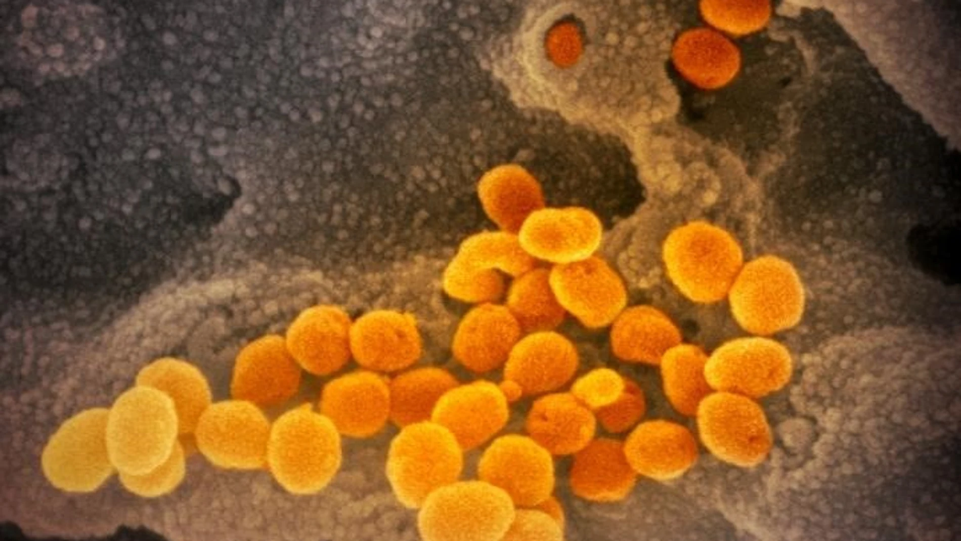Esta imagen de microscopio electrónico de barrido muestra el SARS-CoV-2 (naranja), el virus que causa la COVID-19, aislado de un paciente en EE.UU
