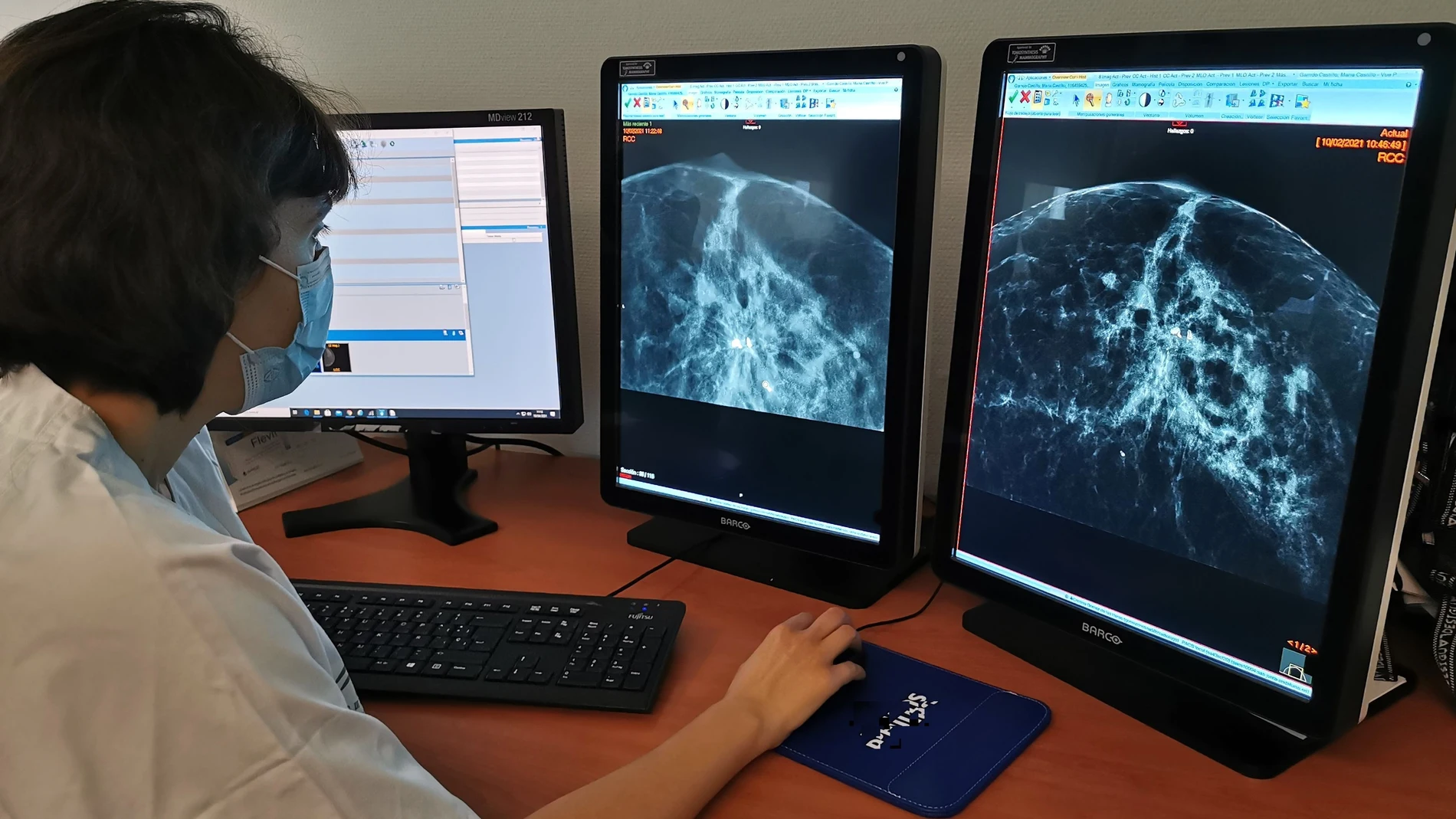 Estudio de mamografía
