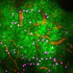 Imagen real mostrando los efectos de la noradrenalina. Los linfocitos se muestran en rosa, los vasos sanguíneos en naranja y en verde puede verse el calcio que actúa como señalizador.