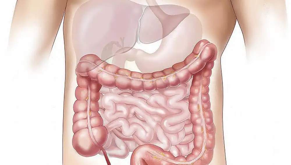 Las bacterias que tenemos en el intestino grueso se encargan de descomponer los alimentos durante la digestión