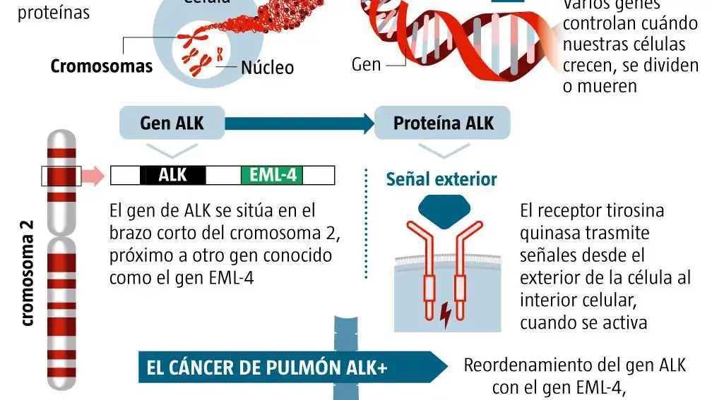 Cáncer de pulmón