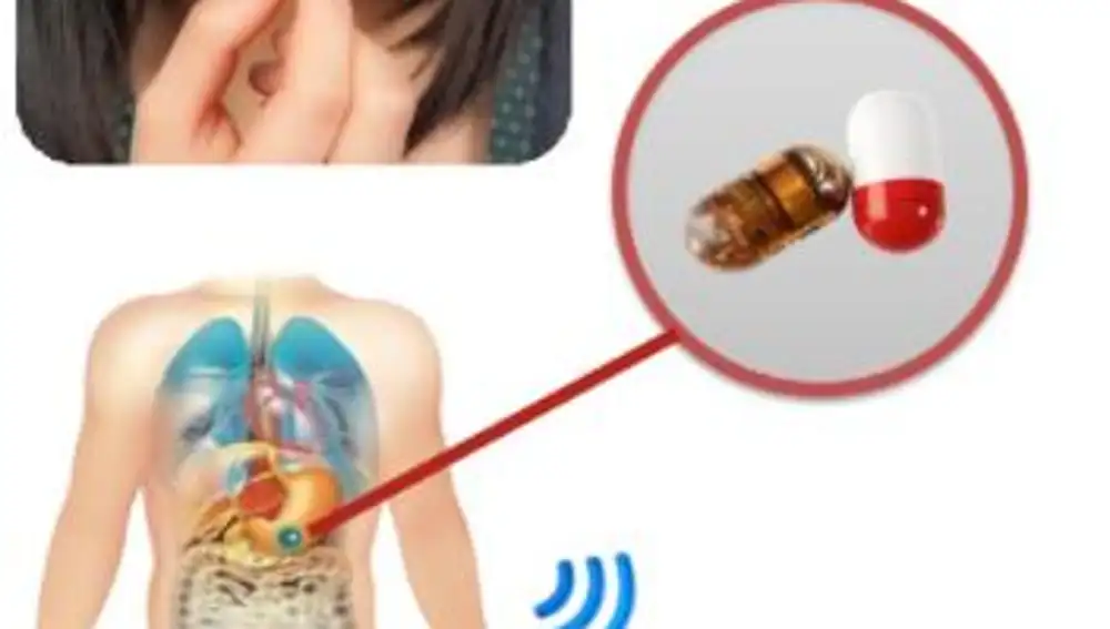 Así funciona e-Celsius