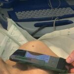 Estudio Iphone y dispositivos cardiovasculares implantados