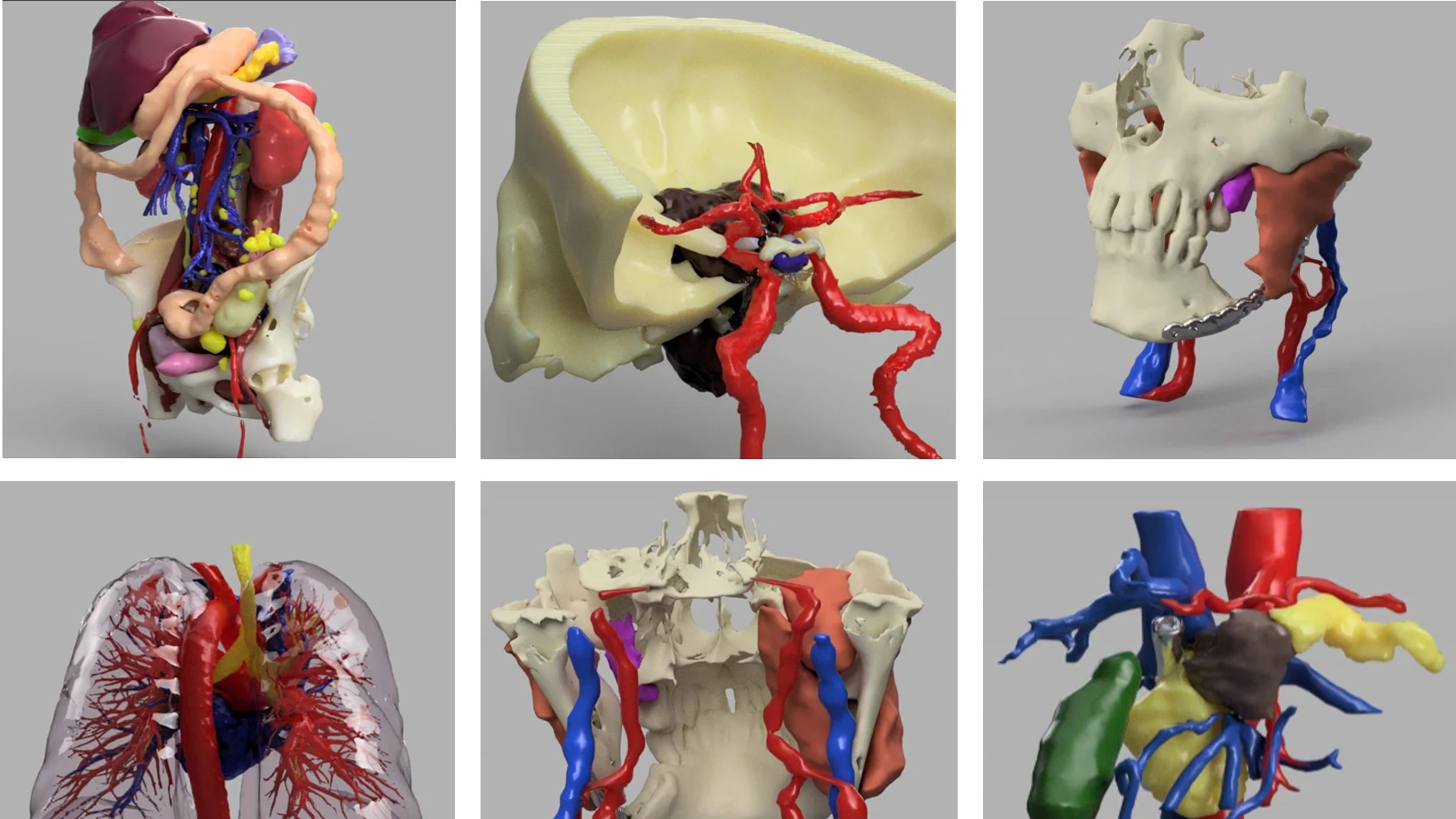Imágenes digitales de algunos modelos 3D realizados en este hospital madrileño