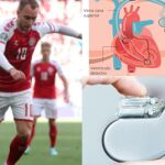 Así funciona un DAI, el desfibrilador que le implantarán a Erikson
