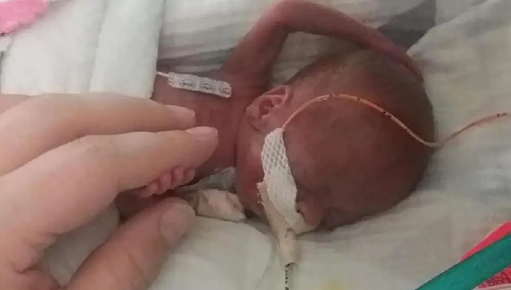 El pequeño Richard en el hospital, a lo pocos días de nacer