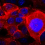 Imagen microscópica de células cancerígenas