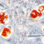 En células de tejido graso (adipocitos), los triglicéridos almacenados en las gotas lipídicas se tiñen con un colorante específico (Oil Red, color rojo)