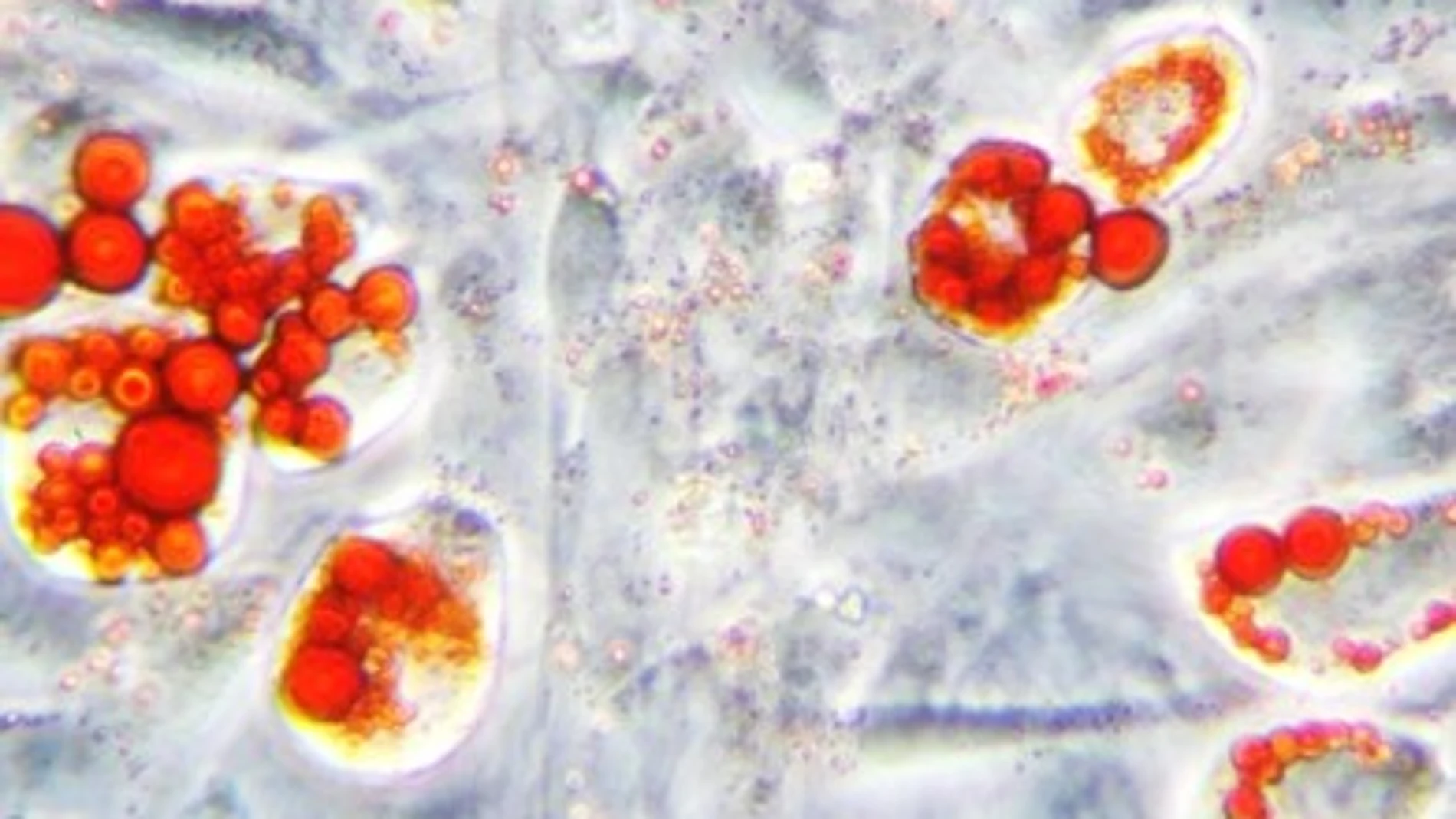 En células de tejido graso (adipocitos), los triglicéridos almacenados en las gotas lipídicas se tiñen con un colorante específico (Oil Red, color rojo)