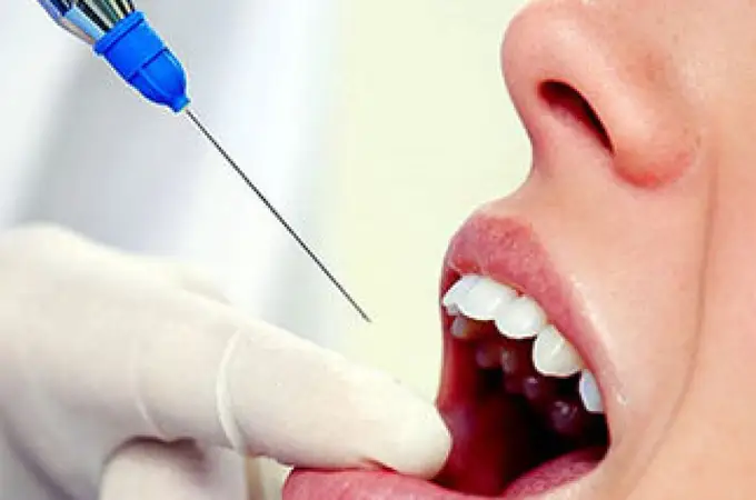 Sale del dentista y se vuelve viral en TikTok: el vídeo que ha conquistado a 10 millones de personas