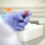 Laboratorio del servicio de Inmunología del Hospital Gregorio Marañón, en Madrid