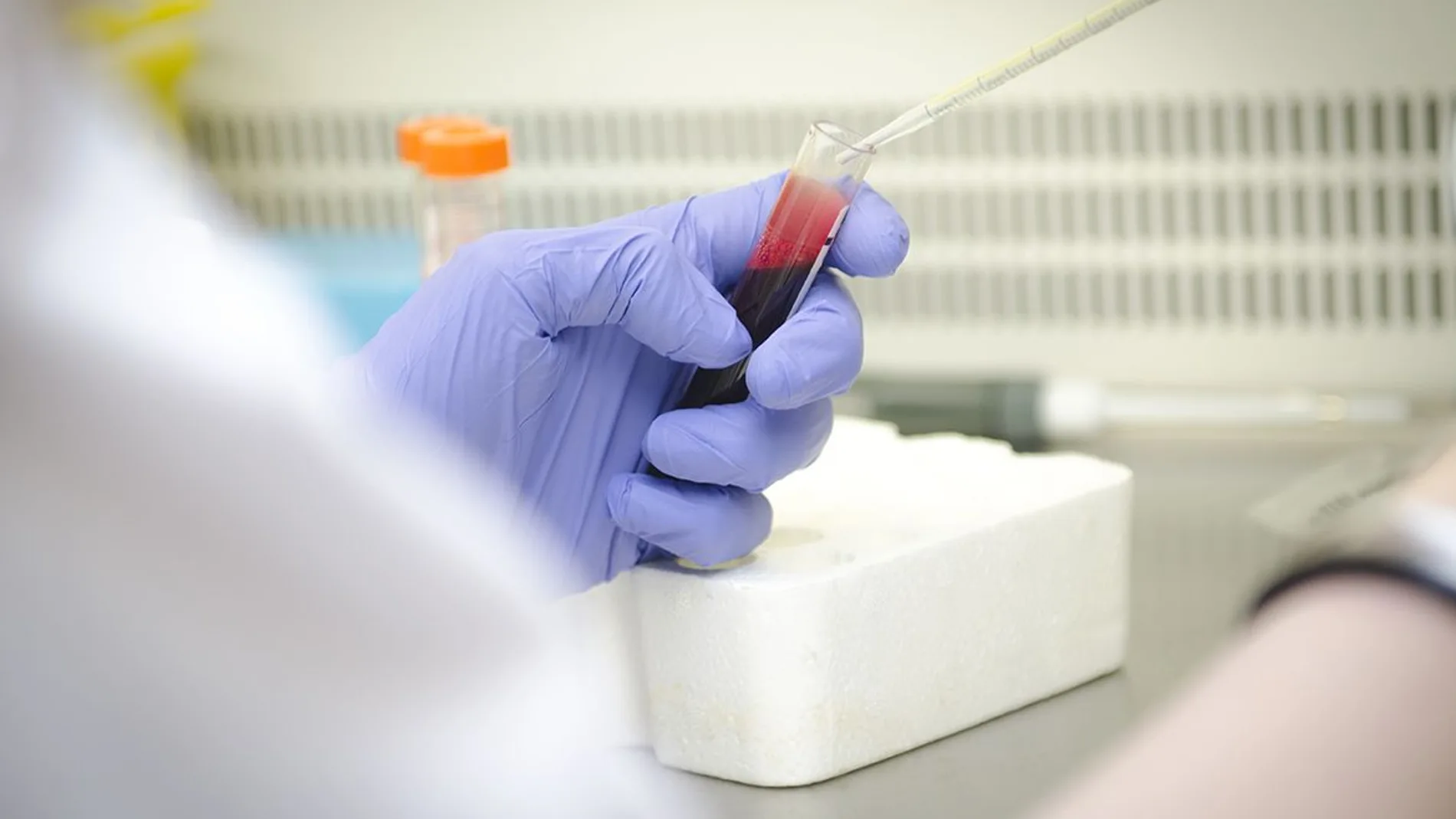 Laboratorio del servicio de Inmunología del Hospital Gregorio Marañón, en Madrid
