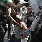 Una manifestante herida hoy, durante las protestas contra el pasaporte covid en París