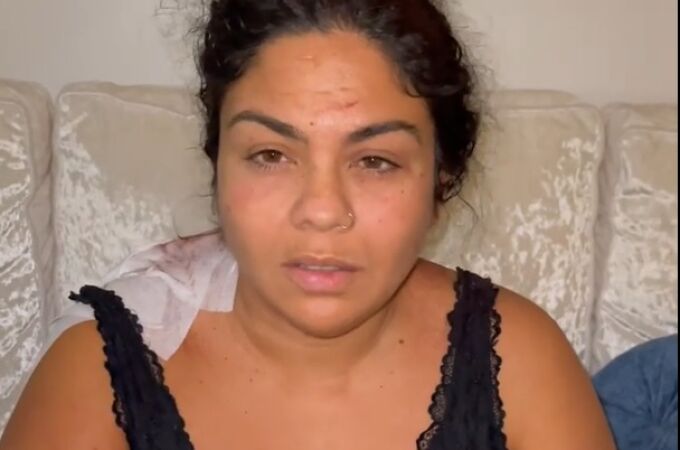 Saray Montoya, herida tras sufrir una agresión