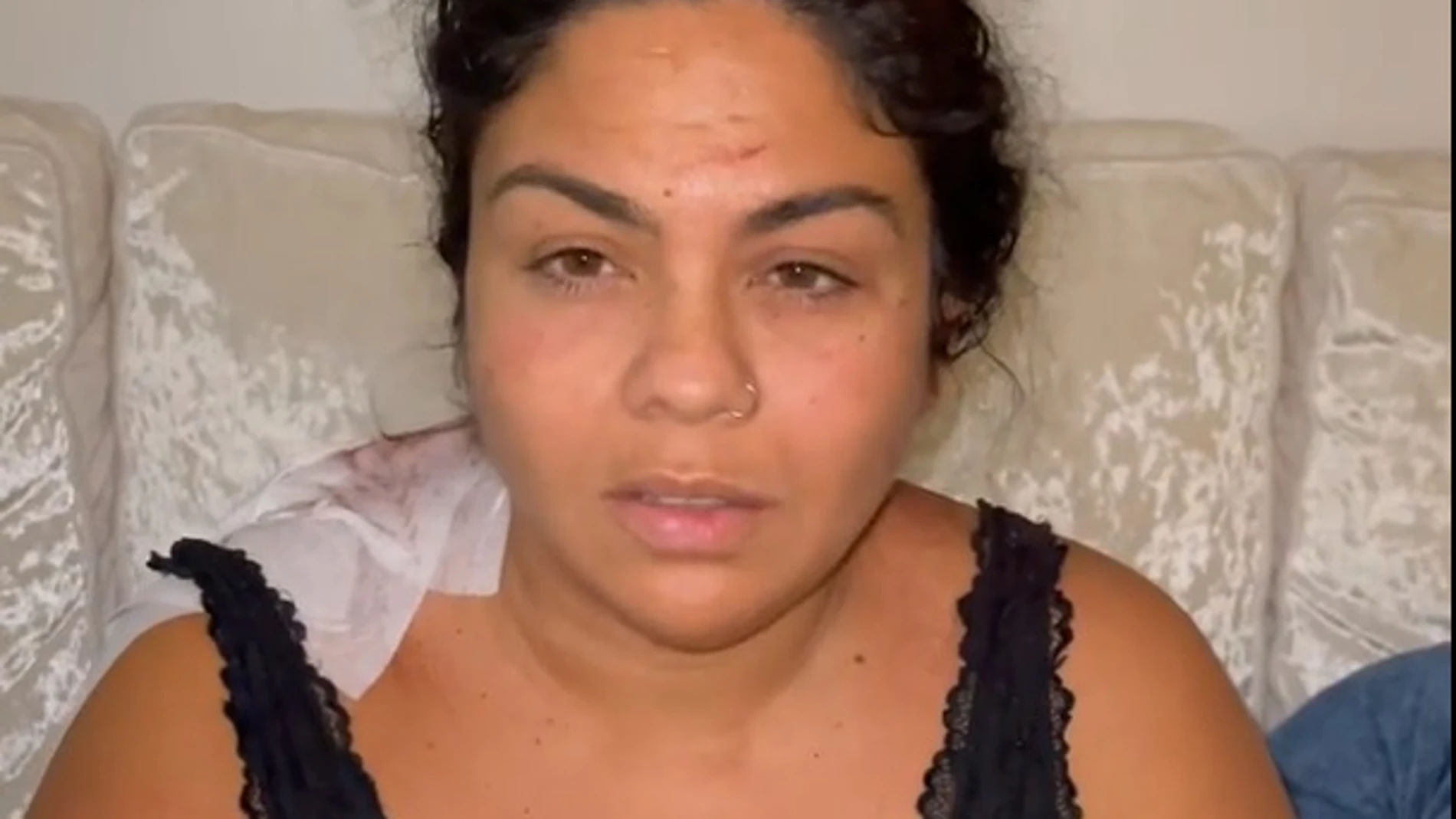 Saray Montoya, herida tras sufrir una agresión