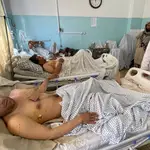 UNo de los heridos en los atentados recibe tratamiento en un hospital REUTER/Stringer NO RESALES. NO ARCHIVES