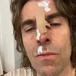 De esta guisa se ha presentado Liam Gallagher en las redes sociales tras «caerse», dice, de su helicóptero